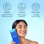 Differin Acne Treatment Gel, 30 Day Supply, Retinoid Treatment for Face with 0.1% Adapalene, Gentle Skin Care for Acne Prone Sensitive Skin, 15g Tube (Packaging May Vary) - Image 5