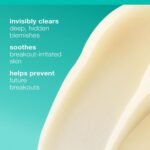 Dermalogica Deep Acne Liquid Patch, Sulfur Acne Treatment with Niacinamide, Invisible Spot Treatment for Blemish-Prone Skin – 0.5 fl oz - Image 3