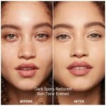 Dark Spot Remover for Face and Body Serum, Dark Spot Corrector for Freckles Melasma Age Spot Sun Spot Brown Spot for Women and Men, 1.7 Fl Oz - Image 5