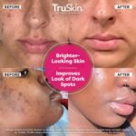 TruSkin Vitamin C Super Serum - Niacinamide, Retinol, Hyaluronic Acid & Squalane - All-in-One Anti Aging Serum for Face – Improve Appearance of Dark Spots, Firmness for Brighter Looking Skin, 1 Fl Oz - Image 3