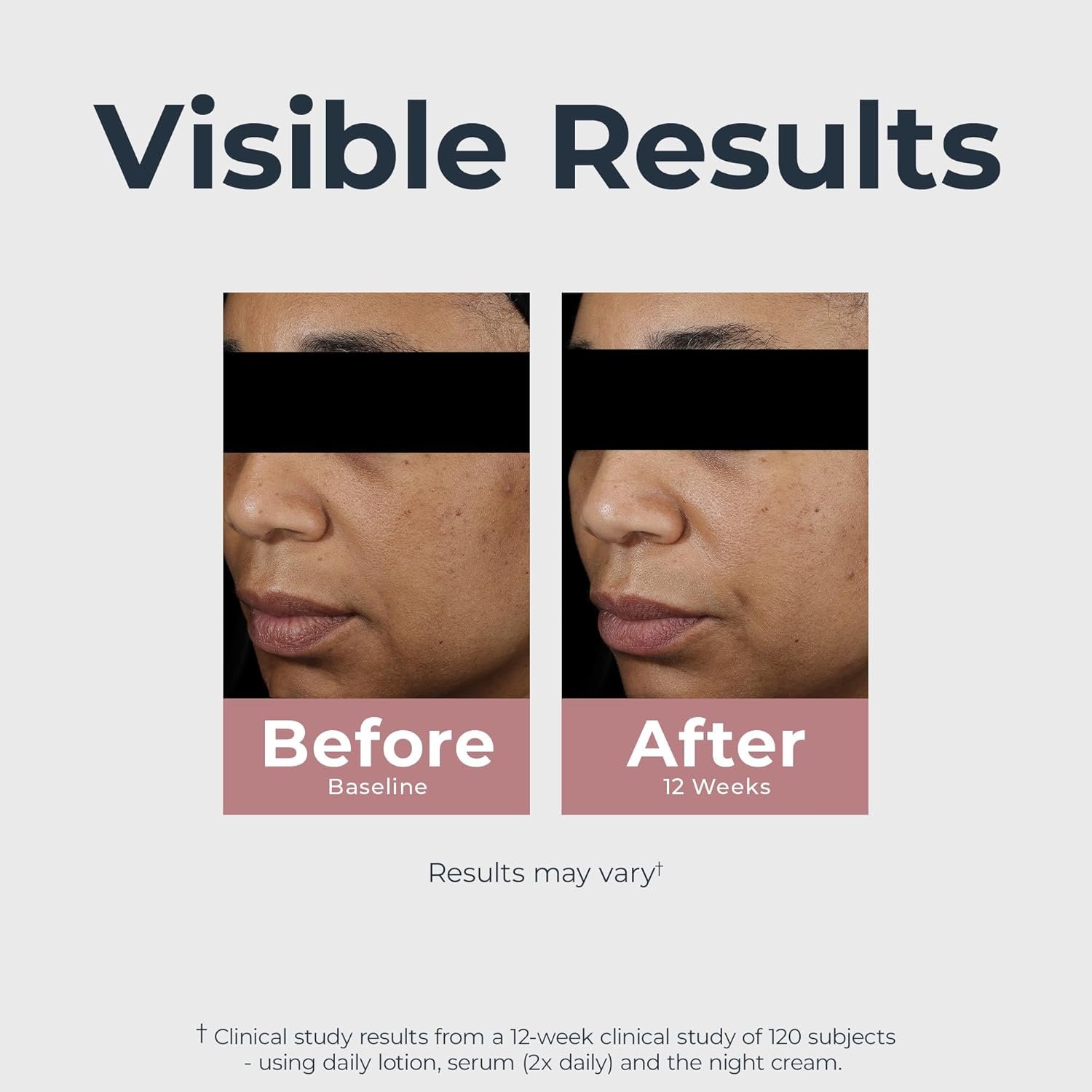 Eucerin Radiant Tone Night Cream, Dark Spot Corrector with Thiamidol, Night Moisturizer for Face Helps Visibly Reduce the Look of Persistent Dark Spots, All Skin Types, 1.7 Oz Bottle - Image 3