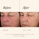 SkinMedica Retinol 0.25 Complex - Retinol Serum for Face, Age-Defying Advanced Retinol Cream That Renews Skin and Diminishes the Appearance of Fine Lines and Wrinkles, 1 Fl Oz - Image 4