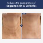 Intense Lifting Neck Cream, Advanced Skin Care with Hyaluronic Acid, Collagen and Shea Butter for Neck Firming and Tightening, 50g, 1.76 oz. - Image 4