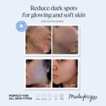 LilyAna Naturals Vitamin C Serum for Face with Hyaluronic Acid and Vitamin E, Anti Aging Serum, Reduces Age Spots and Sun Damage, Promotes Collagen and Elastin (1oz) - Image 3