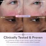 Olay Super Serum Trial Size - Niacinamide, Vitamin C & E, Collagen Peptide, AHA - 5-in-1 Skin Care Benefits - Healthy Glow, Brightening, Hydrating, Smoothing, Firming, Evens Tone, Anti-Aging, 0.4 Oz - Image 6