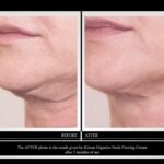 Kleem Neck Firming Cream | Retinol Moisturizer for Face & Décolleté | Anti Aging Cream for Women | Smooth Fine Lines, Wrinkles & Crepey Skin | Hydrating Collagen & Peptides | Made in USA | 1.7 oz - Image 3