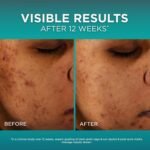 L’Oréal Paris Bright Reveal 12% [Niacinamide + Amino Sulfonic + Ferulic] Dark Spot Serum 1oz + Moisturizer Sample - Image 5