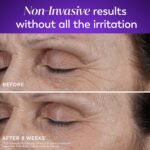 Olay Retinol Night Cream for Women, MAX, Anti-Aging Face Mousturizer, Fragrance-Free, Non Greasy - Anti-Wrinkle, Smooth Fine Lines, Hydrating Skin Care - Triple Collagen Cream, Niacinamide, 1.7oz - Image 9