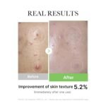 Medicube Exosome Cica Tea Tree Ampoule for Sensitive Skin with Centella Asiatica help reduce redness and breakouts. Low-irritating, Moisturizing & Soothing Serum | Korean Skincare | 30ml - Image 6