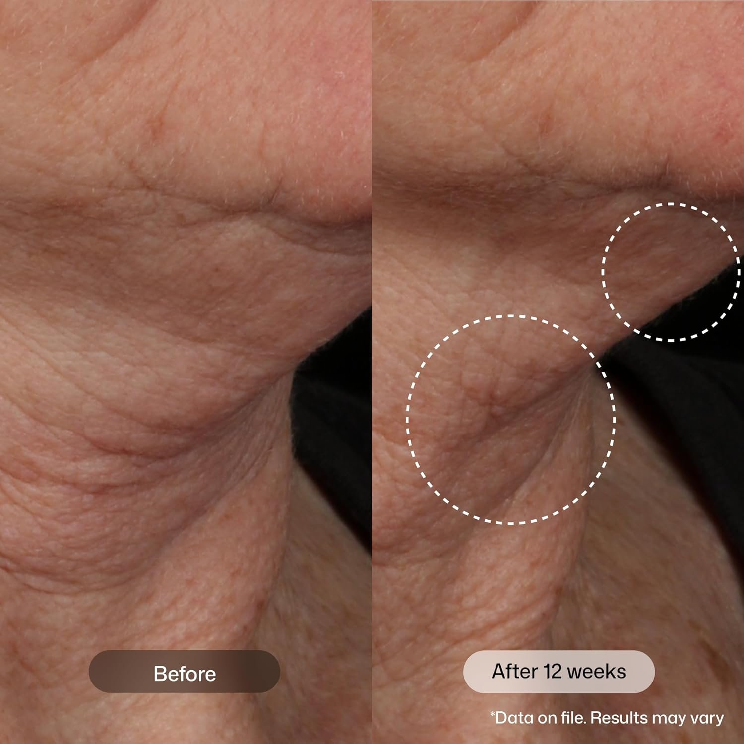 Revision Skincare Nectifirm Advanced® Neck Cream – Clinically Proven to Firm, Lift & Contour the Neck, Jawline & Décolletage, Correcting Visible Signs of Aging and Weight Loss - Image 3