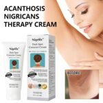 Acanthosis Nigricans Therapy Cream,Dark Spot Remover For Body,Dark Spot Corrector Cream,- Underarm, Neck, Armpit, Knees, Elbows, Private Areas, Intimate Areas - Upgraded Formula, - 2.1Fl Oz - Image 4