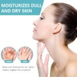 Acanthosis Nigricans Therapy Cream,Dark Spot Remover For Body,Dark Spot Corrector Cream,- Underarm, Neck, Armpit, Knees, Elbows, Private Areas, Intimate Areas - Upgraded Formula, - 2.1Fl Oz - Image 5